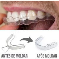 Kit 4 Placas Para Bruxismo Termomoldável + Case De Brinde