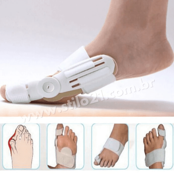 Corretor Ortopédico Articulado De Joanete - Ortopod® [COMPRE 1 E LEVE 2]